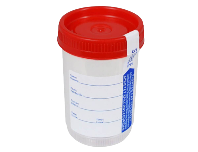 URINE CONTAINER
